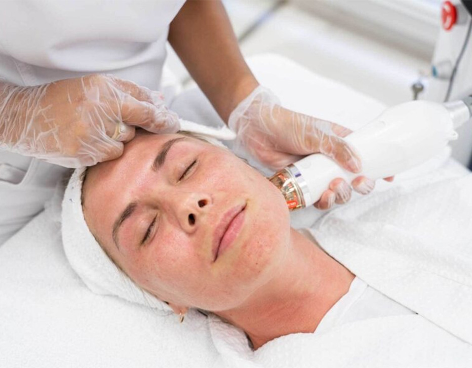 skin-rejuvenation-rf-microneedling