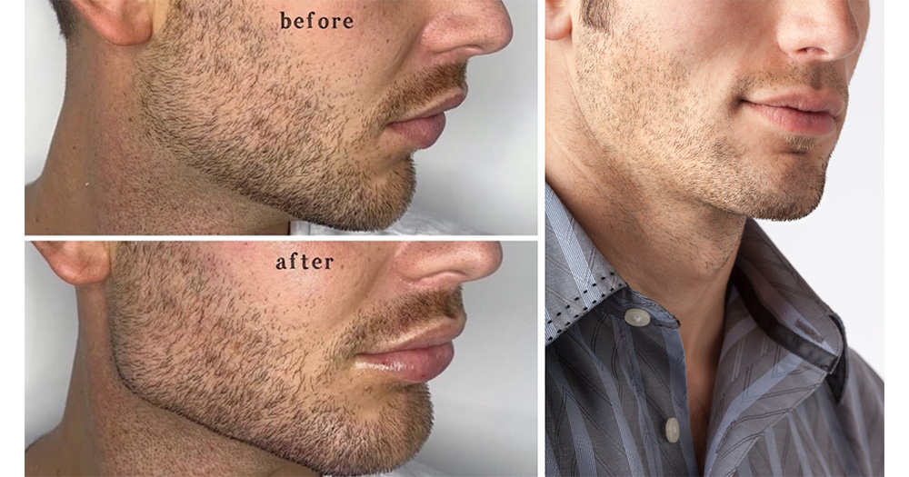 Mens Injectables